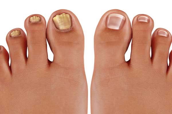 ��ָ����ʲô�� ��ָ����ôԤ��